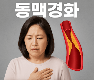 동맥경화증 초기 증상 검사, 예방법