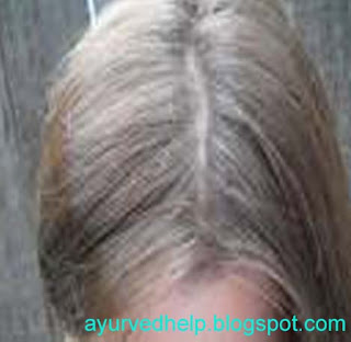 grey hair natural ayurvedic home remedies
