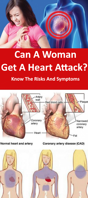 Can A Woman Get A Heart Attack? Know The Risks And Symptoms