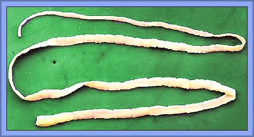 A Tapeworm - Not What You Want Inside You!