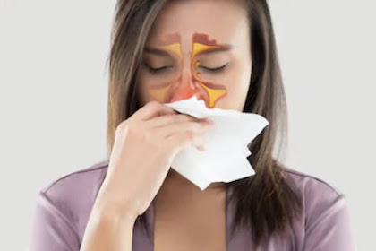 Penyakit Sinusitis : Gejala, Penyebab, Dan Pengobatannya