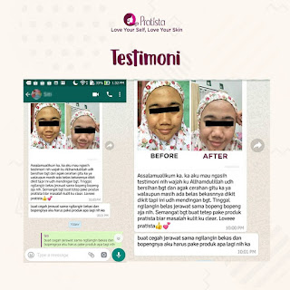 Testimoni Cara Ampuh Mencerahkan Dan Menghilangkan Bekas Jerawat,Scar/Bopeng Pratista (114)