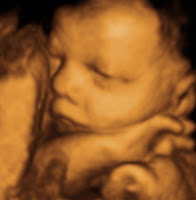 3d Ultrasounds2