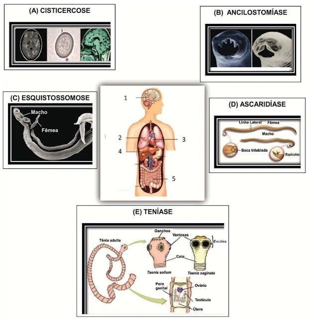 Identifique a alternativa que descreve CORRETAMENTE as características das verminoses quanto à localização do parasita no corpo humano, o seu ciclo de vida e a presença de hospedeiro intermediário. Considere as informações contidas nas figuras, conforme esquema a seguir