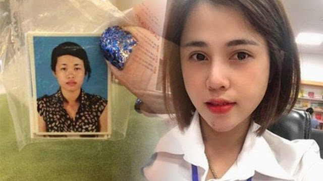 Ditinggalkan Pacarnya Karena Punya Wajah Jelek, Wanita Ini Lakukan Oplas Hingga Menjadi Cantik