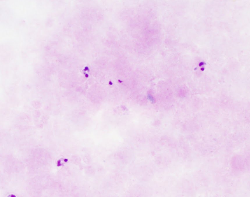 The following were seen on a Giemsa-stained thick blood film made from EDTA 