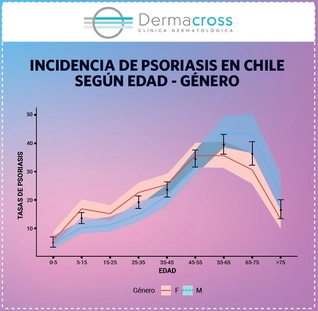 Primer estudio de incidencia de psoriasis en Chile