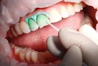 современная стоматологическая технология