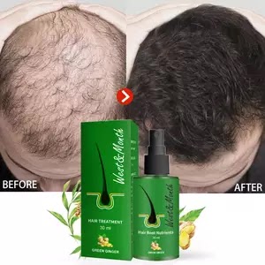 AD 30ml Hair Growth Products Ginger Anti Hair Loss Spray Serum Anti-loss Oil Scalp Dry Frizzy Treatment Strong Root Essential Oils New in US $0.01 US $12.22-99% New User Bonus 262 sold4.8 Free Shipping