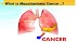 What is mesothelioma cancer?