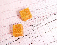Dificultades cardiovasculares asociadas a la diabetes