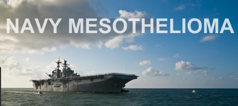 Five Mesothelioma Navy That Had Gone Way Too Far.