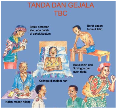 Gambar Ilustrasi : Tanda dan Gejala Penyakit TBC Paru