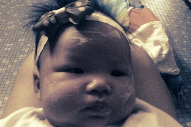heat rash on babies pictures. Baby+heat+rash+on+face