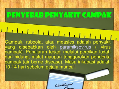 campak