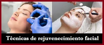 Las 5 técnicas más usadas para un rejuvenecimiento facial total