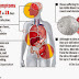 Ebola: The "Zombie" Virus which is Shaking the World!