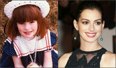 Rare Unseen Childhood Photos of Hollywood Actress Anna Hathaway