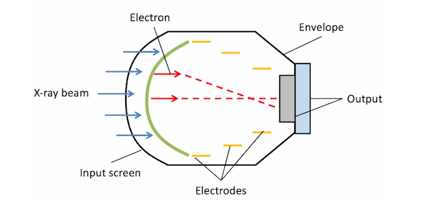 Image Intensifier Fluoroscopy