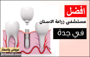 افضل مستشفى لزراعة الاسنان في جدة