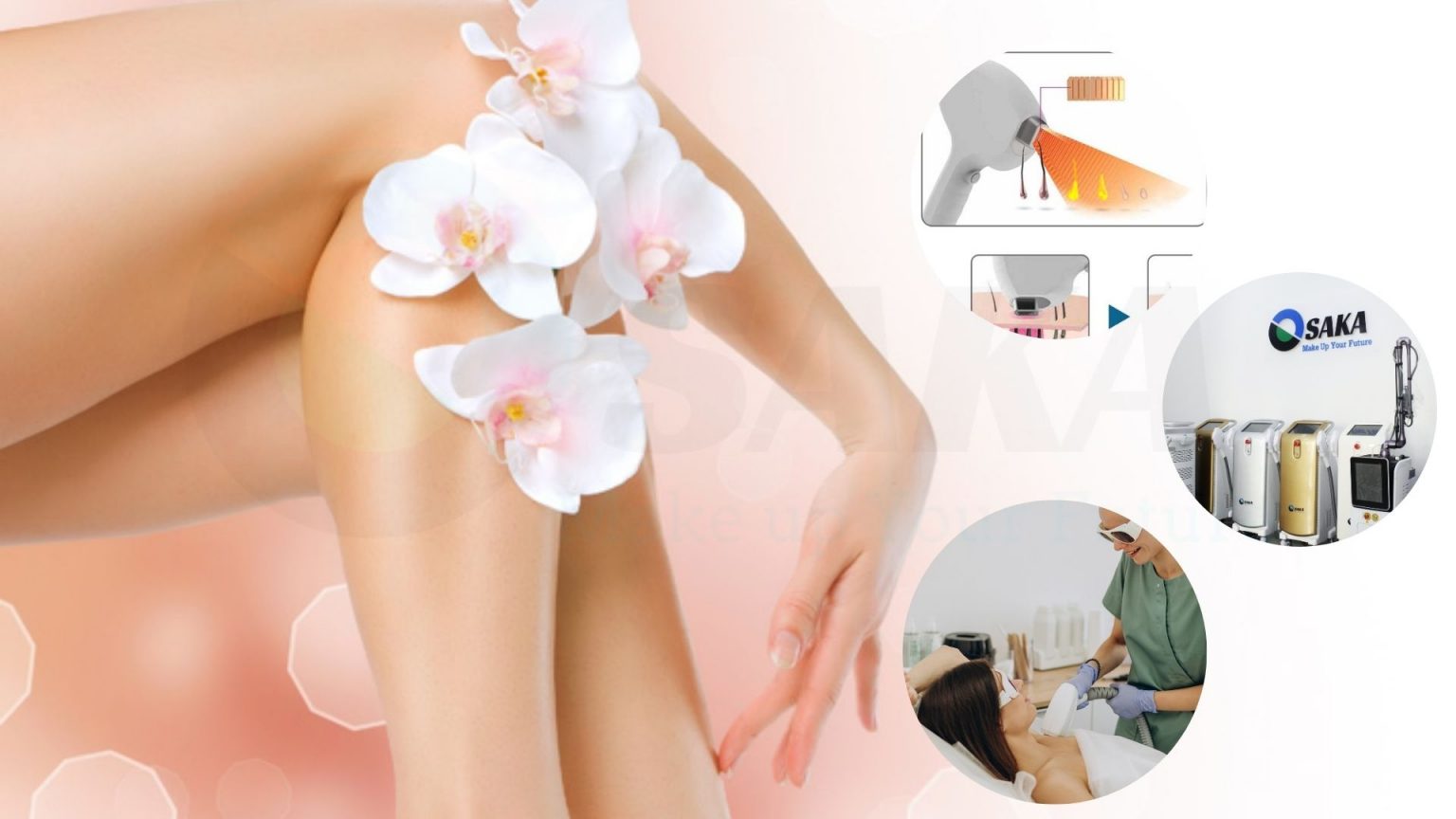 Tẩy lông bằng phương pháp laser