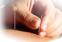 ilmu pengobatan akupuntur