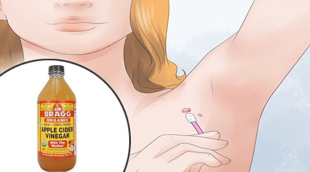 7 Easy Ways to Remove Skin Tags Without Seeing a Doctor