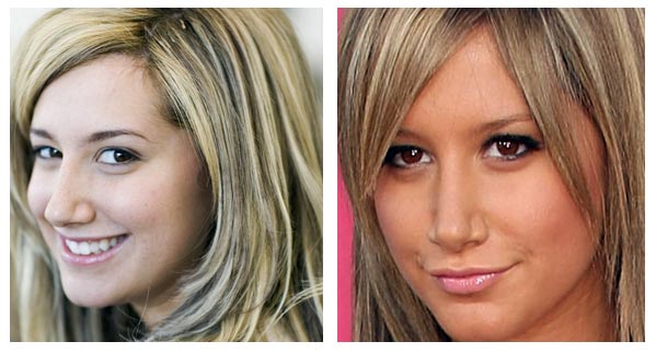 ashley tisdale nose job. Ashley Tisdale Nose Job Before
