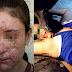    สุดสะเทือนใจ!! สาววัย 18 โดนทำร้ายเเละลงเเขก ซ้ำยังถูกทารุณทางใบหน้า ด้วยเหตุผลที่ใครก็รับไม่ได้!! (ชมคลิป)