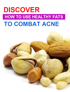 Discover How to Use Healthy Fats to Combat Acne