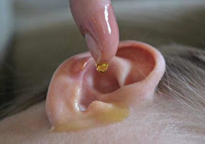 One of The Best Home Remedies for Ear Infections and Earwax