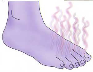 Cara Mengatasi bau kaki