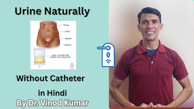 How to Do Urine Naturally Without Catheter