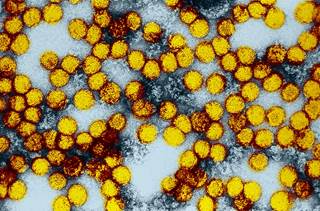 Dose fracionada da vacina contra a Febre Amarela  estimula resposta imune eficaz - New England Journal of Medicine