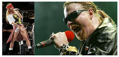 Axl: Then and Now