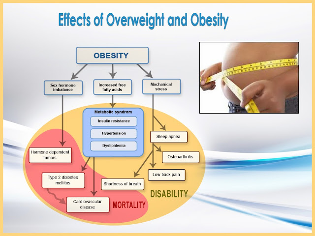 Obesity PowerPoint Template