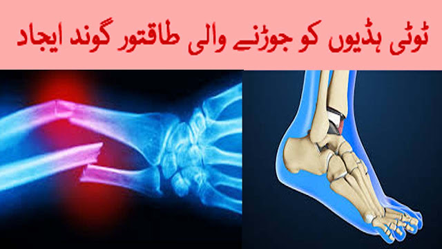 Instant Treatment For Joint Pain | breaking bone joints glue | Bone Fracture Treatment