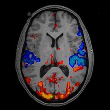 mri brain scan. Picturing the Brain