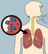  Penyakit tuberkulosis paru