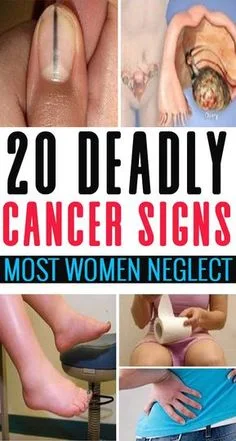 20 Deadly Cancer Signs Most Women Neglect 