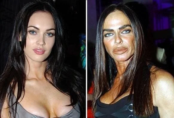 Celebrity Plastic Surgery Mishaps That Left Fans Stunned