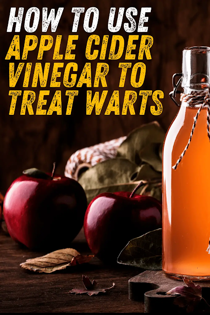 How To Use Apple Cider Vinegar for Treat Warts