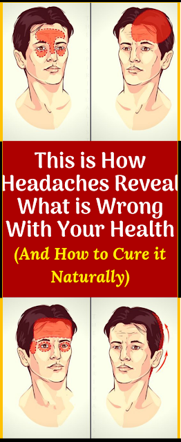 This Is How Headaches Reveal What Is Wrong With Your Health (And How To Cure It Naturally!)