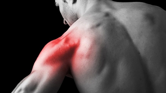 Things You Need to Know About Muscle Soreness