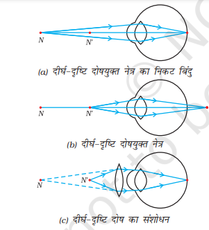Far-sightedness in hindi