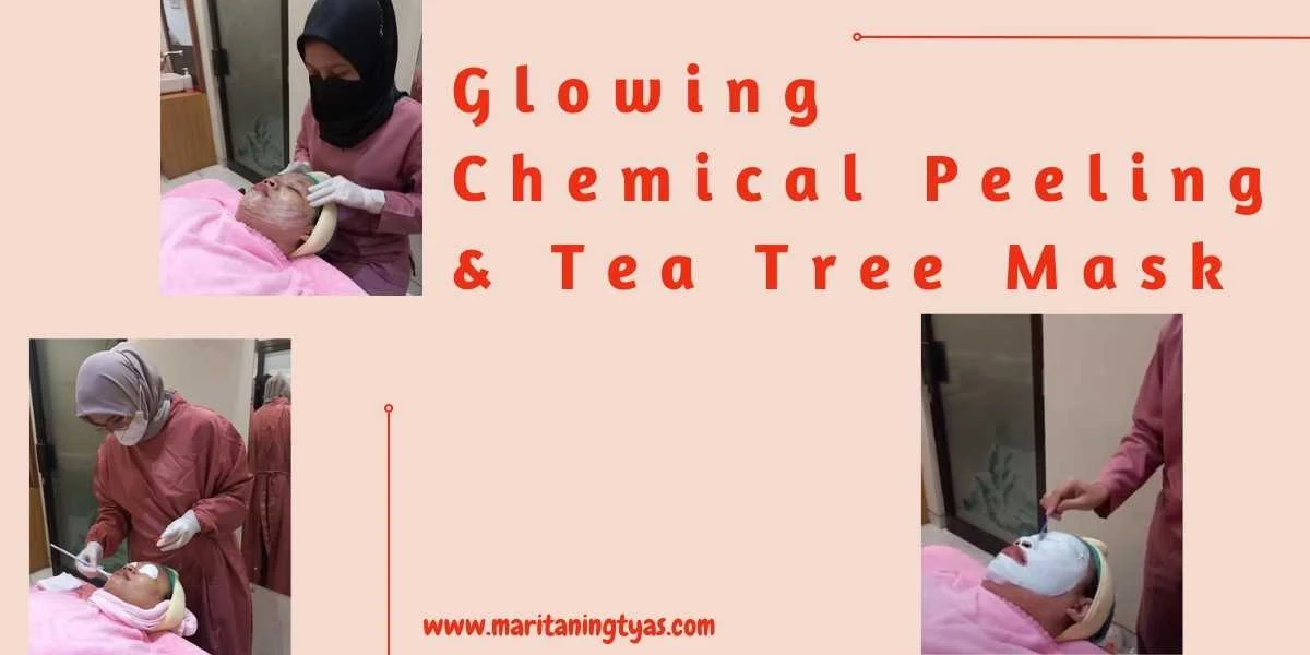 glowing chemical peeling Seby Clinic
