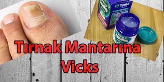 Tırnak Mantarına Vicks