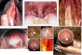 http://obat-kencing-nanah-alami.blogspot.com/