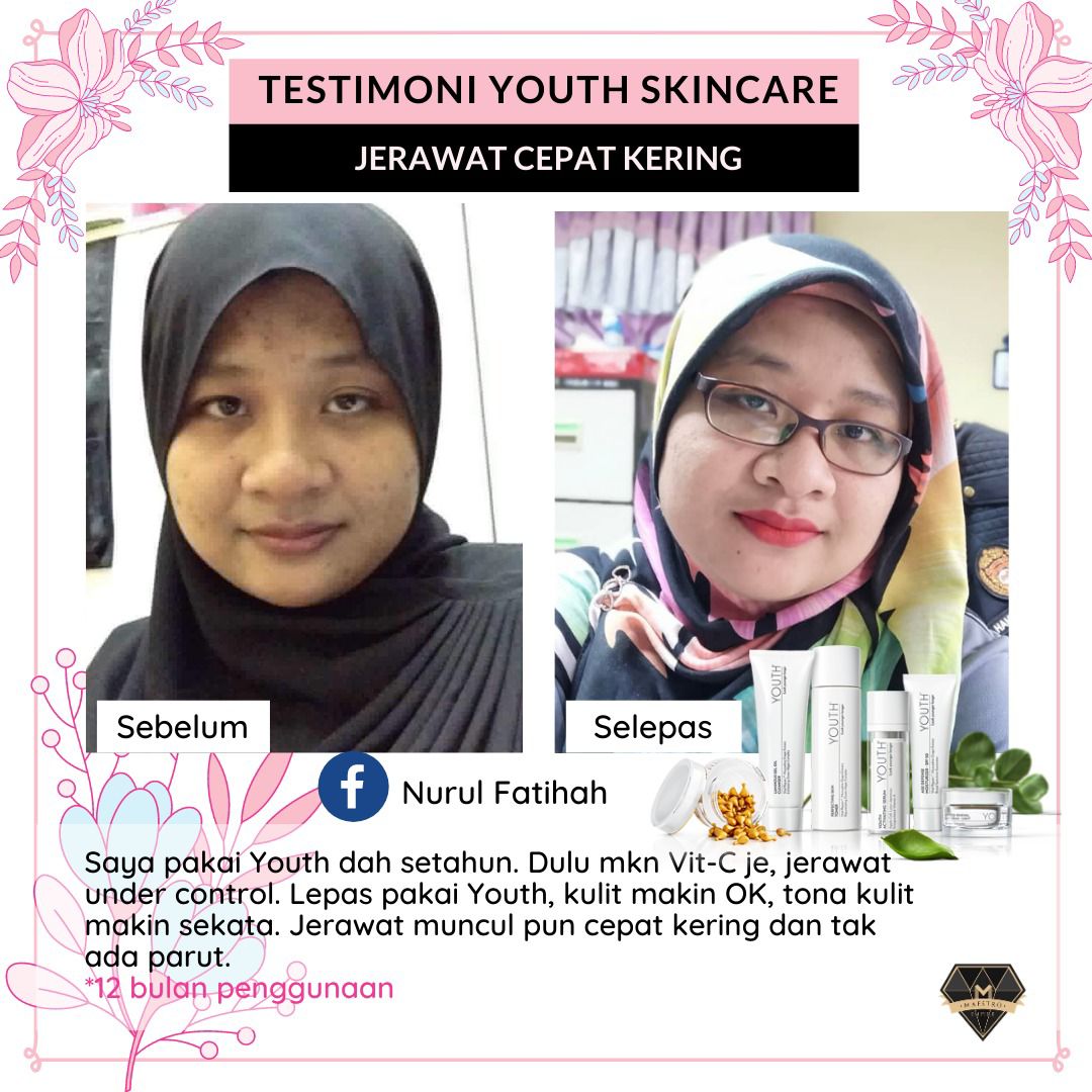 Testimoni YOUTH Skincare untuk Kulit Berjerawat dan Berparut