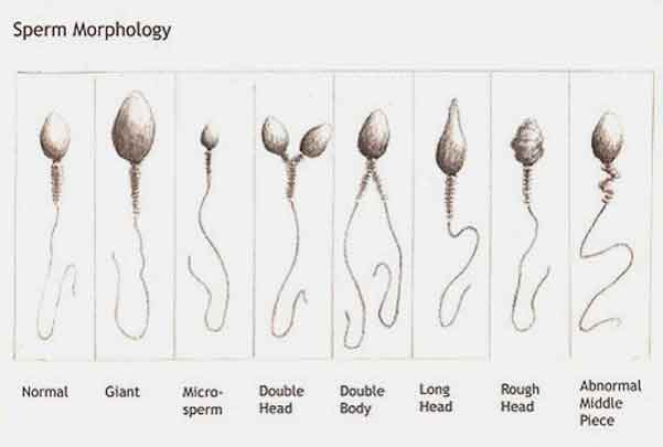 Morfologi Bentuk Sperma Normal